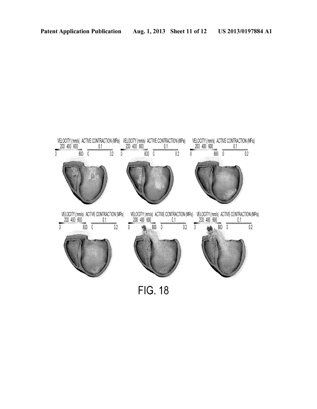 Method and System for Advanced Measurements Computation and Therapy     Planning from Medical Data and Images Using a Multi-Physics Fluid-Solid     Heart Model - diagram, schematic, and image 12