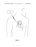 RETRIEVAL OF INFORMATION FROM AN IMPLANTABLE MEDICAL DEVICE diagram and image