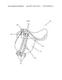 STABILIZING SYSTEM FOR A SADDLE diagram and image