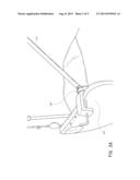 STERILE DRAPE SUPPORT diagram and image