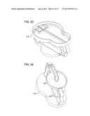 SYSTEMS, METHODS AND APPARATUS FOR STAIN REMOVAL diagram and image