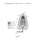 HEMODIALYSIS SYSTEM HAVING A FLOW PATH WITH A CONTROLLED COMPLIANT VOLUME diagram and image