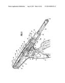 SURGICAL STAPLING DEVICE diagram and image