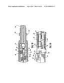 SURGICAL STAPLING DEVICE diagram and image