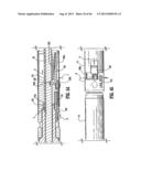 SURGICAL STAPLING DEVICE diagram and image