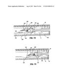 SURGICAL STAPLING DEVICE diagram and image