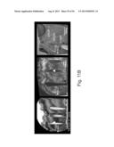 GALLIUM NITRIDE BASED STRUCTURES WITH EMBEDDED VOIDS AND METHODS FOR THEIR     FABRICATION diagram and image