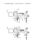 Accessory Cart diagram and image