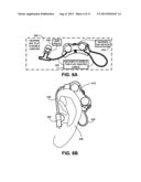 FLEXIBLE SILICONE CABLE JUNCTION SYSTEM AND METHOD diagram and image