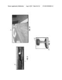 INTERNAL IMAGING SYSTEM diagram and image