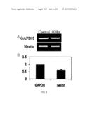 METHOD FOR INDUCING DIFFERENTIATION OF MESENCHYMAL STEM CELLS TO NERVE     CELLS USING SOUND WAVES diagram and image