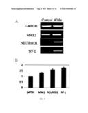 METHOD FOR INDUCING DIFFERENTIATION OF MESENCHYMAL STEM CELLS TO NERVE     CELLS USING SOUND WAVES diagram and image