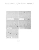 METHOD FOR INDUCING DIFFERENTIATION OF MESENCHYMAL STEM CELLS TO NERVE     CELLS USING SOUND WAVES diagram and image