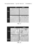 IMMUNOGENIC COMPOSITIONS AGAINST TUBERCULOSIS diagram and image