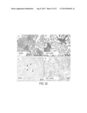 IMMUNOGENIC COMPOSITIONS AGAINST TUBERCULOSIS diagram and image