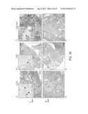 IMMUNOGENIC COMPOSITIONS AGAINST TUBERCULOSIS diagram and image