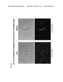 ACTIVATION OF INNATE IMMUNITY FOR NUCLEAR REPROGRAMMING OF SOMATIC CELLS diagram and image