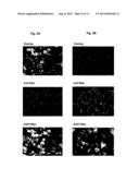 SET OF OLIGONUCLEOTIDE PROBES AS WELL AS METHODS AND USES THERETO diagram and image