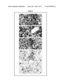 Novel Inhibitors of LYN Kinase and Methods Using Same diagram and image