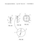 Apparatus and Methods For Treating Pulmonary Hypertension diagram and image