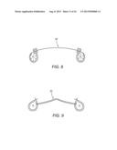 Apparatus and Methods For Treating Pulmonary Hypertension diagram and image