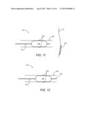 Apparatus and Methods For Treating Pulmonary Hypertension diagram and image