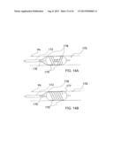 Apparatus and Methods For Treating Pulmonary Hypertension diagram and image