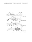 Apparatus and Methods For Treating Pulmonary Hypertension diagram and image