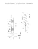 Apparatus and Methods For Treating Pulmonary Hypertension diagram and image