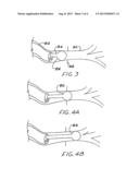 BRACHYTHERAPY APPARATUS AND METHOD FOR USE WITH MINIMALLY INVASIVE     SURGERIES OF THE LUNG diagram and image