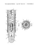 Medical Device with a Deflectable Shaft Section and Tension Control diagram and image