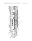 Medical Device with a Deflectable Shaft Section and Tension Control diagram and image