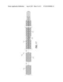 Medical Device with a Deflectable Shaft Section and Tension Control diagram and image