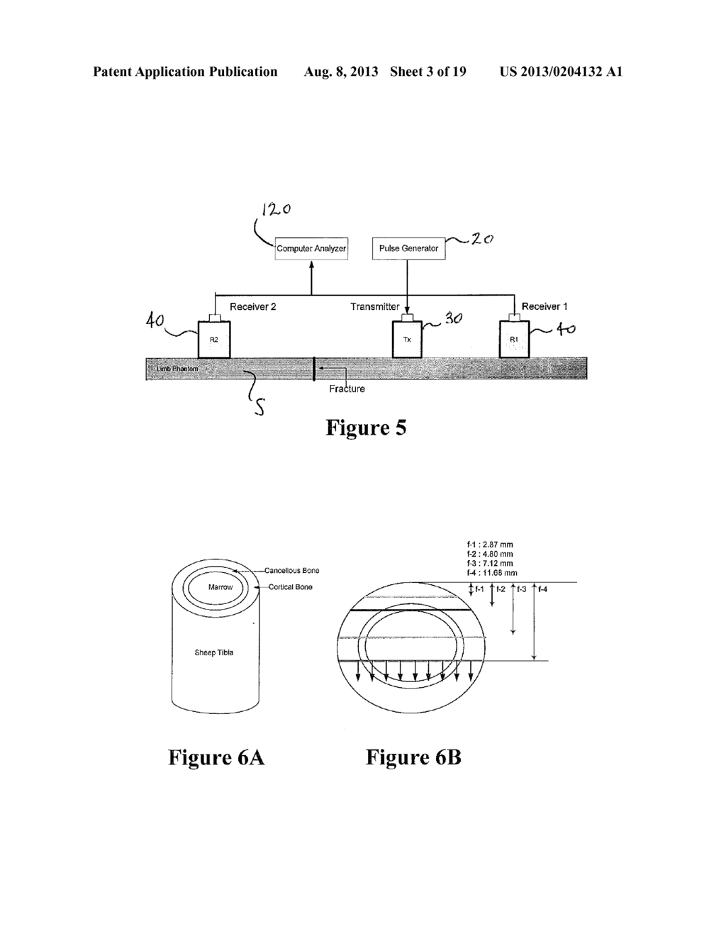 SYSTEM AND METHOD FOR ULTRASOUND ANALYSIS OF BIOLOGICAL STRUCTURES - diagram, schematic, and image 04