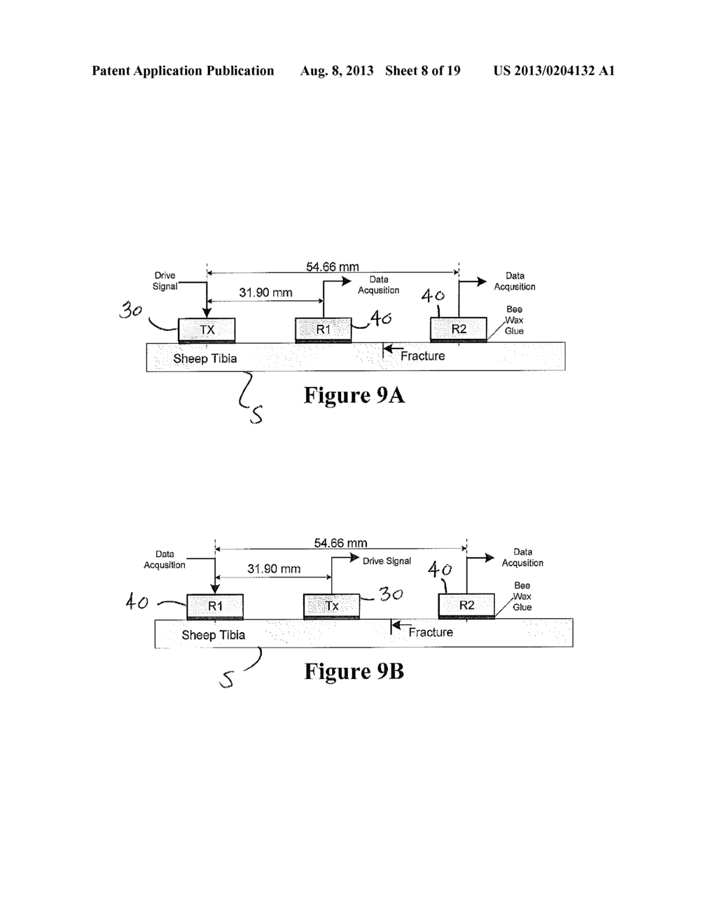 SYSTEM AND METHOD FOR ULTRASOUND ANALYSIS OF BIOLOGICAL STRUCTURES - diagram, schematic, and image 09