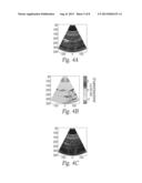 FILTERING SYSTEMS AND METHODS FOR SUPRESSION OF NON-STATIONARY     REVERBERATION IN ULTRASOUND IMAGES diagram and image