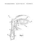 LACRIMAL DRAINAGE MANOMETER AND METHOD OF USE diagram and image