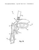 LACRIMAL DRAINAGE MANOMETER AND METHOD OF USE diagram and image