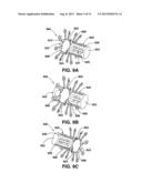 Arteriovenous Shunt Having a Moveable Valve diagram and image