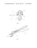 INTERNAL ASYMMETRICALLY DESIGNED 8-SHAPED STEEL PLATE FOR TEMPORARY     HEMIEPIPHYSIODESIS AND APPLICATION THEREOF diagram and image