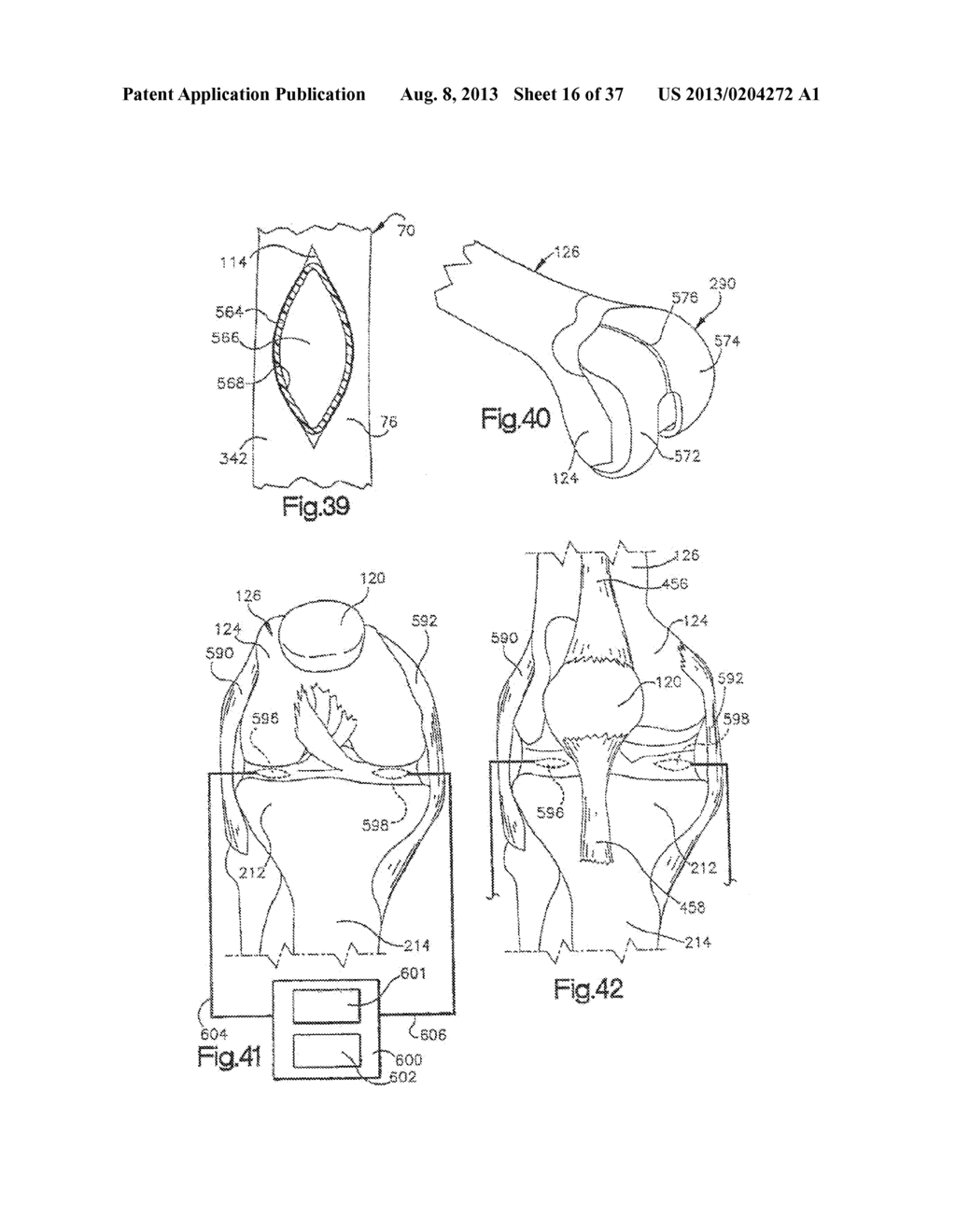 METHOD FOR ROBOTIC ARTHROPLASTY USING NAVIGATION - diagram, schematic, and image 17