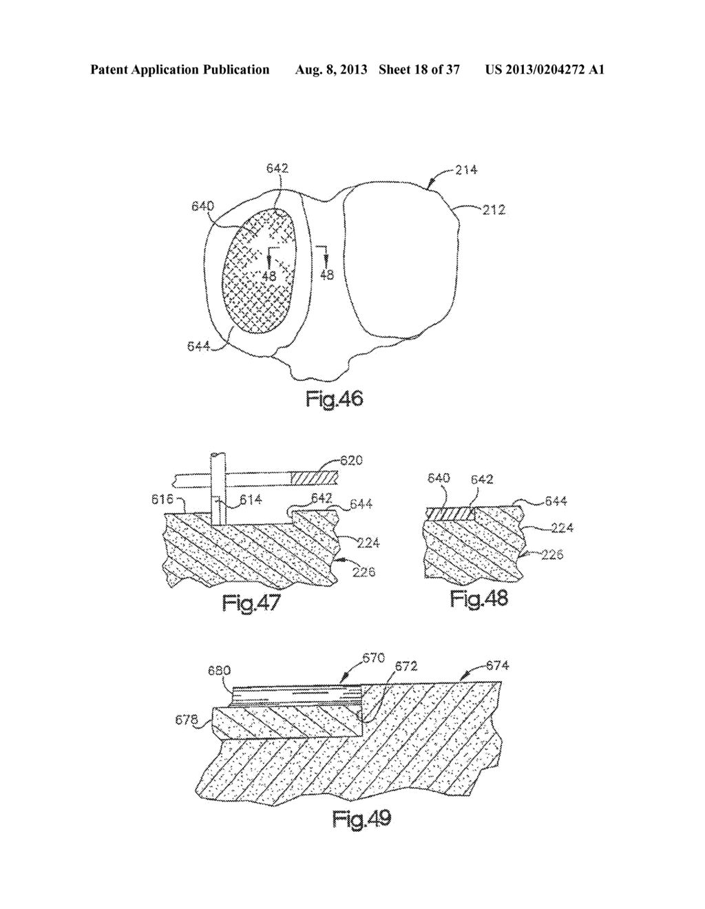 METHOD FOR ROBOTIC ARTHROPLASTY USING NAVIGATION - diagram, schematic, and image 19