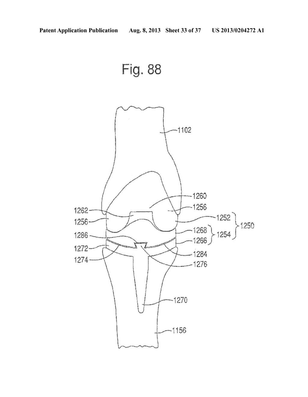 METHOD FOR ROBOTIC ARTHROPLASTY USING NAVIGATION - diagram, schematic, and image 34