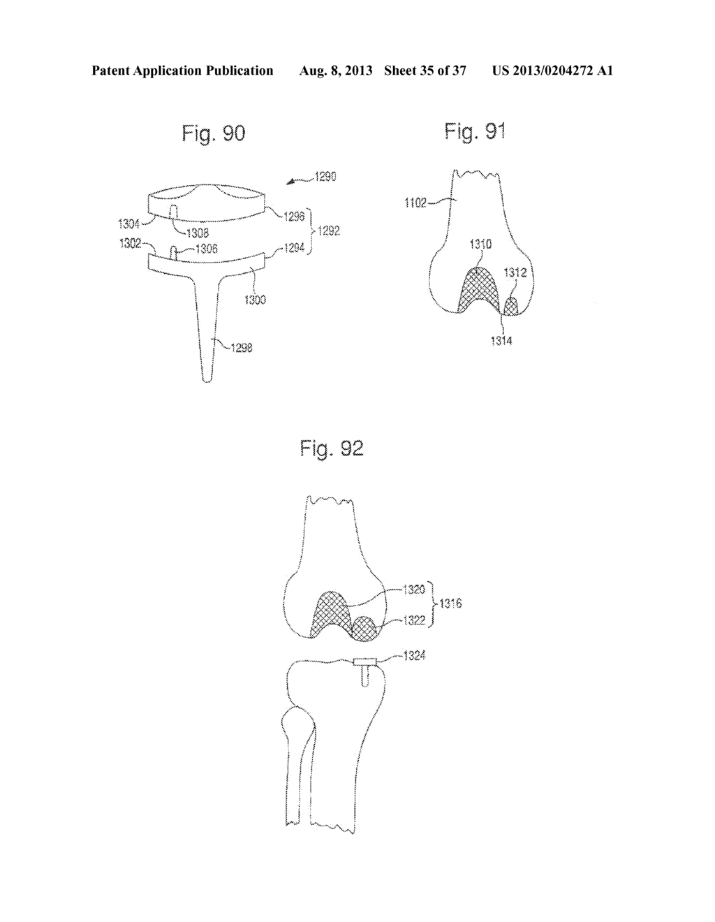 METHOD FOR ROBOTIC ARTHROPLASTY USING NAVIGATION - diagram, schematic, and image 36