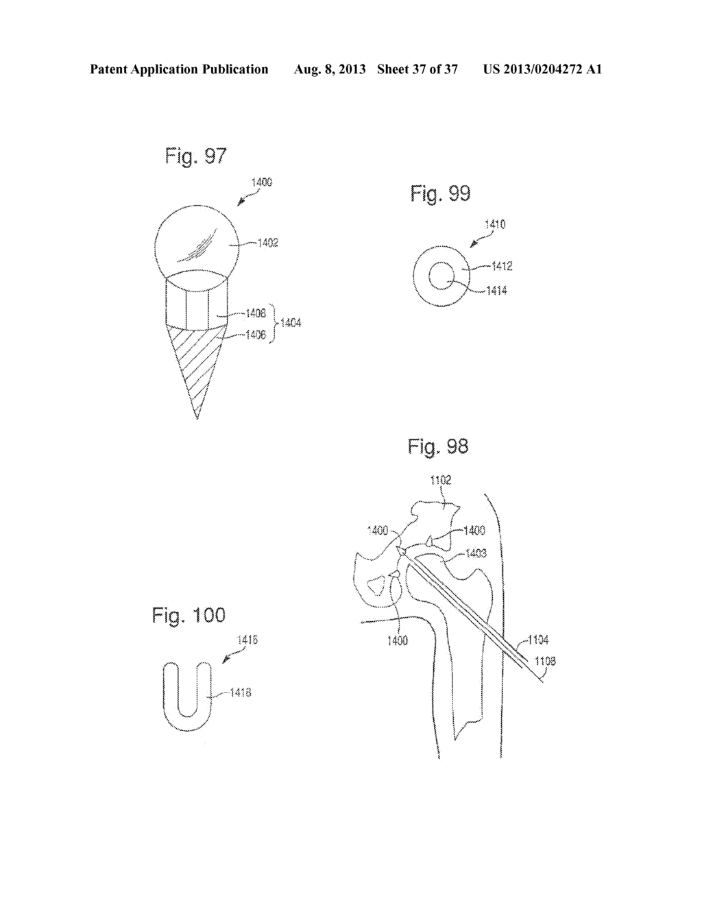 METHOD FOR ROBOTIC ARTHROPLASTY USING NAVIGATION - diagram, schematic, and image 38