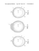 Rotational Atherectomy Device with Fluid Inflatable Support Elements and     Distal Protection Capability diagram and image