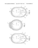 Rotational Atherectomy Device with Fluid Inflatable Support Elements and     Distal Protection Capability diagram and image