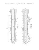 Rotational Atherectomy Device with Fluid Inflatable Support Elements and     Distal Protection Capability diagram and image