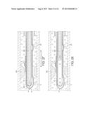 Rotational Atherectomy Device with Fluid Inflatable Support Elements and     Distal Protection Capability diagram and image