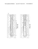 Rotational Atherectomy Device with Fluid Inflatable Support Elements and     Distal Protection Capability diagram and image